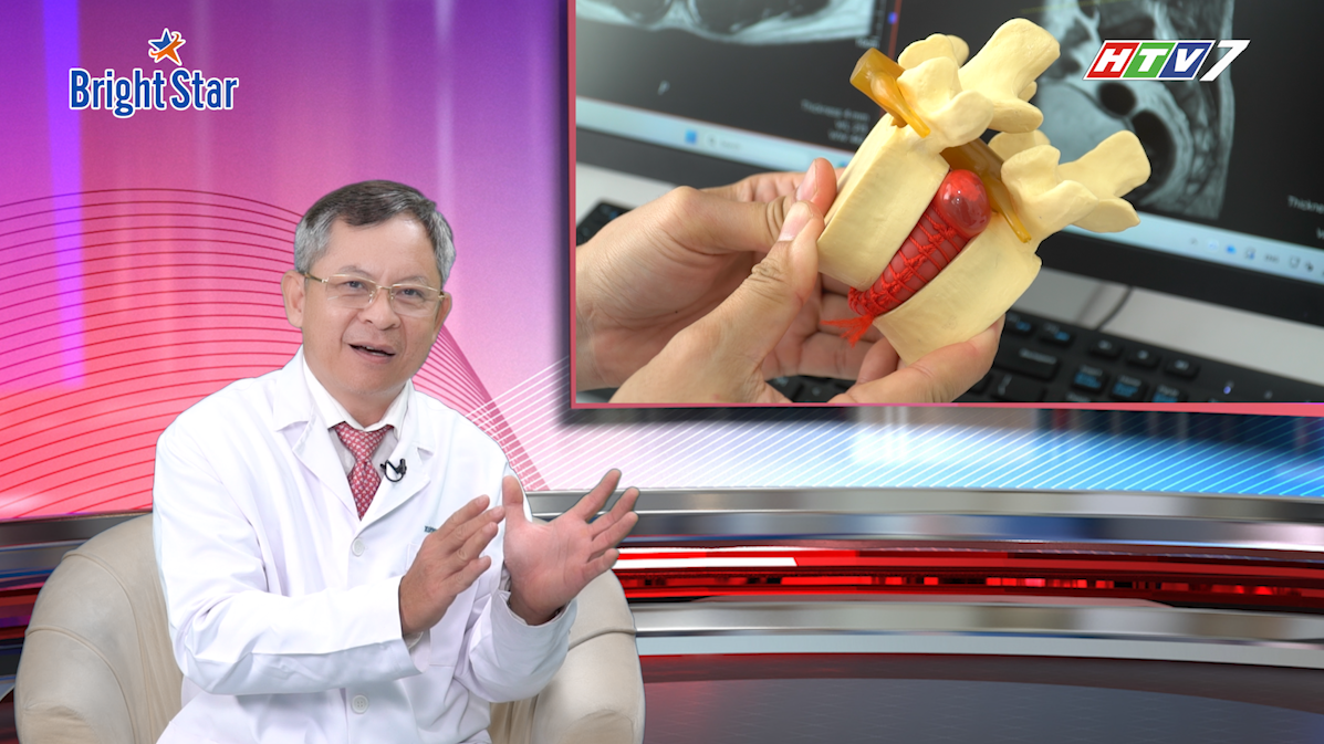 Bác sĩ Vui Vẻ TS. BS Tăng Hà Nam Anh gỡ rối nỗi lo thoát vị đĩa đệm
